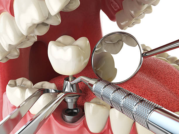 Best Emergency Denture Repair in Seaville, NJ